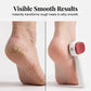 🔥 Hot sale 49% OFF🔥Double-Sided Foot Scraper for Callus Removal